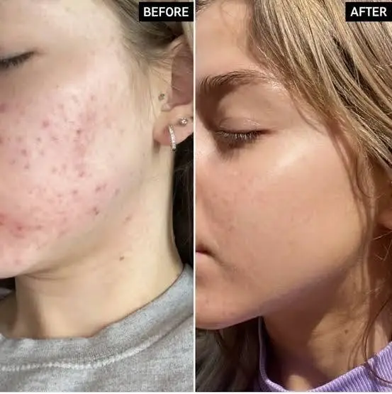 The Ordinary Serum 1